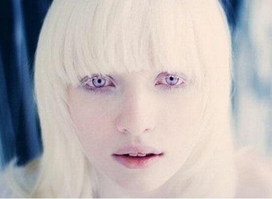 世界上稀有的银眼睛人多数竟是白化病人艾薇儿银眼睛似精灵
